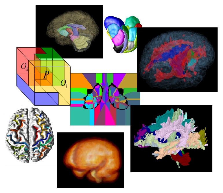 MRG Seminar Brain Image Segmentation Goldsmiths, University of London