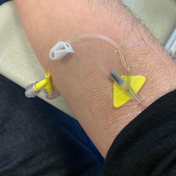 An arm with a IV line inserted into it.