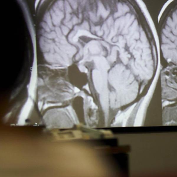 Images of human brains are projected onto a screen.
